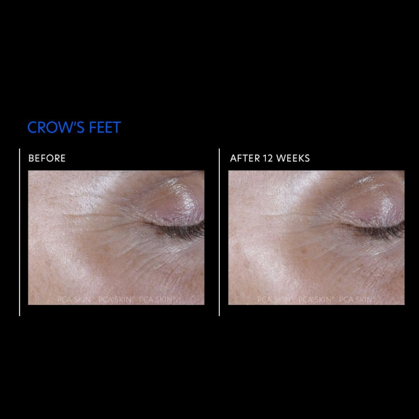 ExLinea® Pro Peptide Serum | PCA Skin