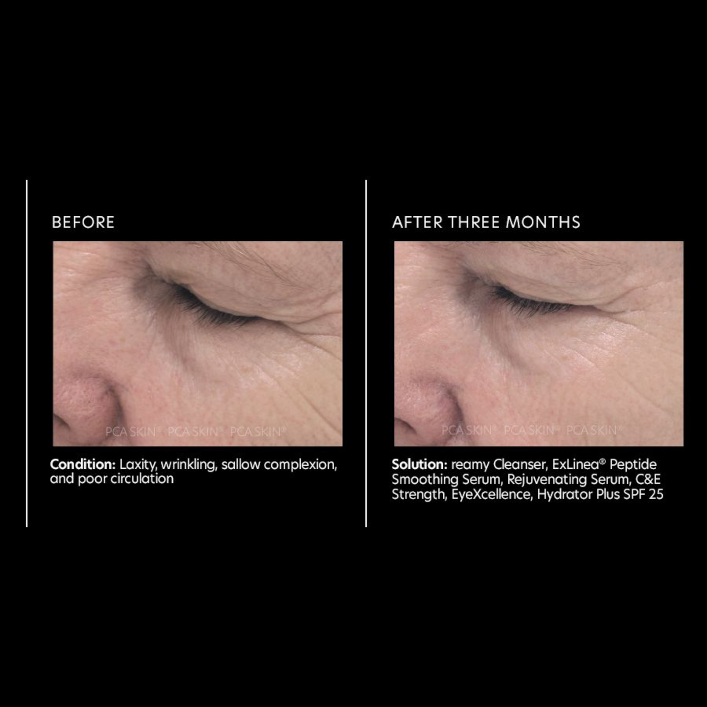 ExLinea® Peptide Smoothing Serum | PCA Skin